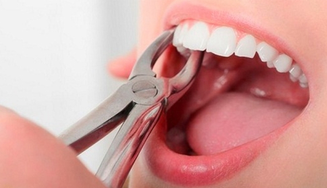 Vì sao rụng hết răng sẽ bị miệng móm? Xem clip này xong bạn sẽ phải cẩn thận với răng miệng của mình