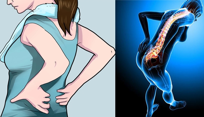 Đừng coi thường đau lưng, đây là dấu hiệu cảnh báo 8 loại bệnh nguy hiểm 