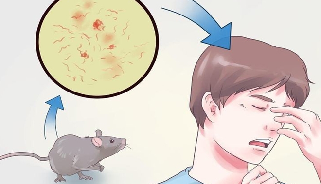 Nguy cơ mắc bệnh nguy hiểm khi bị chuột cắn, chớ chủ quan! 