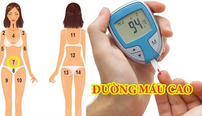 Chú ý, vị trí mụn xuất hiện trên cơ thể cũng tiết lộ bạn đang mắc bệnh đấy nhé! 