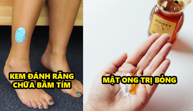 Những mẹo sơ cứu vết thương nghe kì lạ nhưng giúp loại bỏ cảm giác đau đớn tức thì 