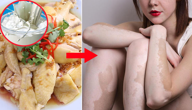 Điều tồi tệ gì sẽ xảy ra cho sức khỏe nếu bạn vừa ăn thịt gà vừa uống sữa? 