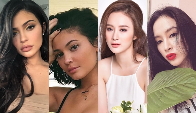 “Nữ hoàng môi tều” Kylie Jenner giờ môi đã xẹp lép, còn sao Việt thì sao?