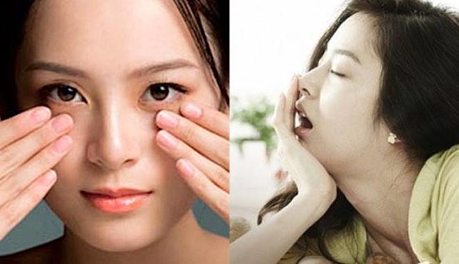 Quầng thâm mắt: Nếu không cảnh báo thiếu máu cũng là căng thẳng cực độ, bạn đừng chủ quan