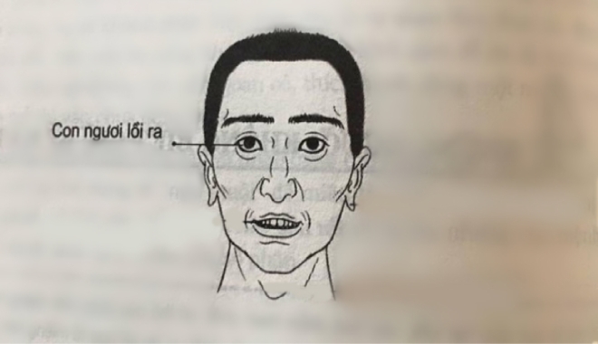 Học người xưa nhận diện tướng người hung hãn, không đáng tin cậy qua vẻ bề ngoài