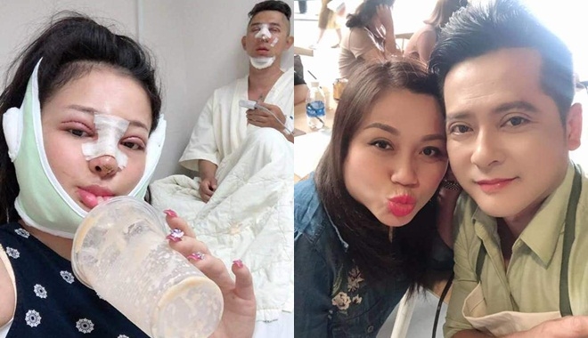 Đâu chỉ cặp đôi Ngân 98, diễn viên “Gạo nếp gạo tẻ” và loạt sao cũng “rủ nhau" dao kéo