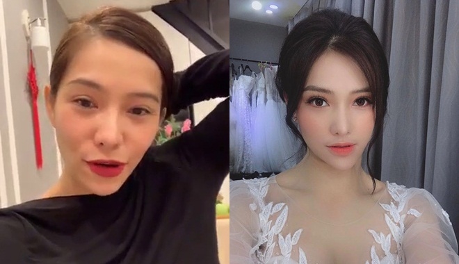 Hậu scandal văng tục, Lưu Đê Ly xuất hiện với chiếc cằm lệch hẳn 