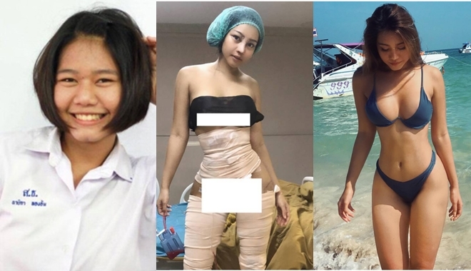 Nóng bỏng mắt trước body bốc lửa của hotgirl Thái sau phẫu thuật, nể nhất là vòng eo 46