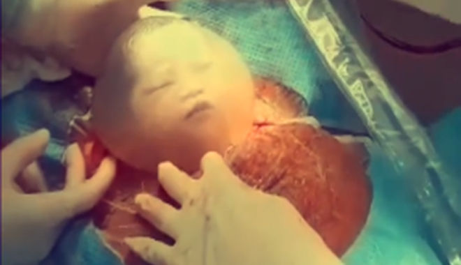 Chào đời trong bọc ối, em bé khiến CĐM thích thú vì chớp mắt mỉm cười