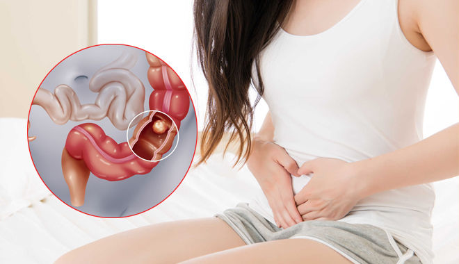 Nhà nghiên cứu Đức: Người phải ngồi quá nhiều mỗi ngày có nguy cơ cao mắc ung thư ruột kết