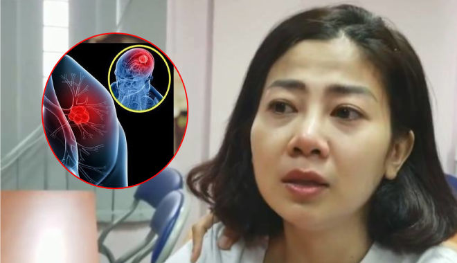 Chuyển biến xấu, Mai Phương bị ung thư di căn vào tim, khán giả cầu mong chị sớm vượt qua