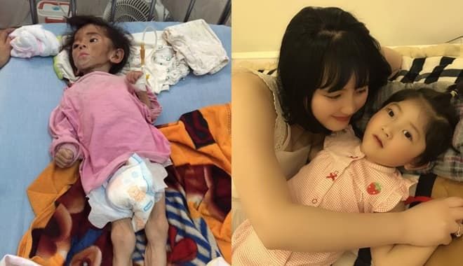 Sau 3 năm được mẹ nuôi chăm sóc, em bé Lào Cai từng suy dinh dưỡng nặng đã bụ bẫm đáng yêu