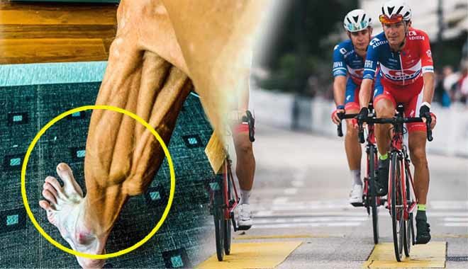 Cựu vô địch đua xe đạp thế giới đăng ảnh đôi chân căng phồng