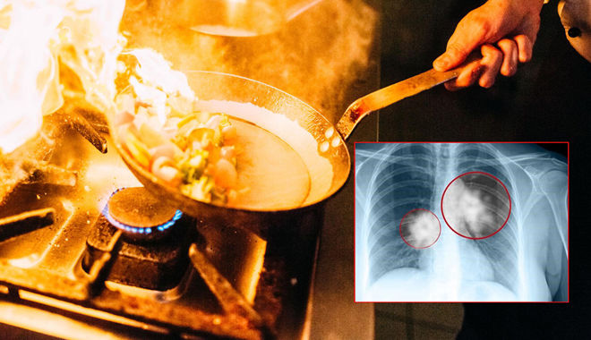 Người đàn ông 42 tuổi mắc ung thư phổi vì làm trong nhà bếp 20 năm