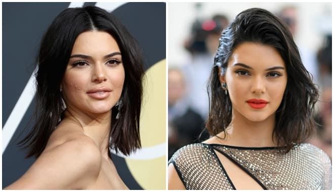  Từng tự ti vì mụn, siêu mẫu Kendall Jenner đã có cách trị hiệu quả