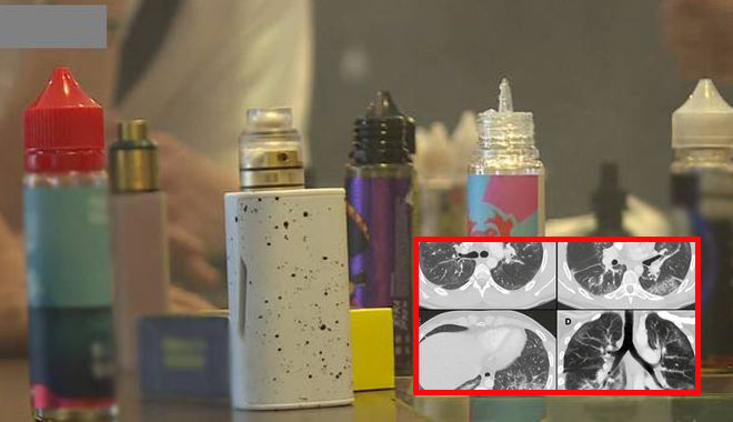 Bác sĩ Abbara: Thuốc lá điện tử độc hại, "đốt cháy" phổi bằng tinh dầu