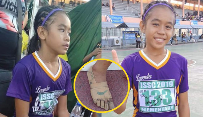 Bé gái 11 tuổi tự chế giày bằng urgo đạt 3 huy chương vàng điền kinh
