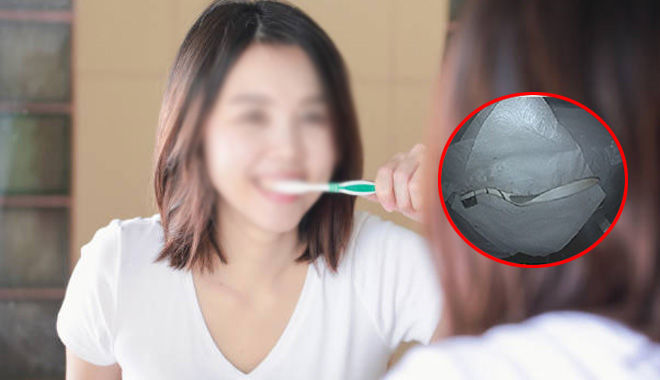 Cô gái 19 tuổi nuốt phải bàn chải khi vừa đánh răng vừa cười đùa lớn