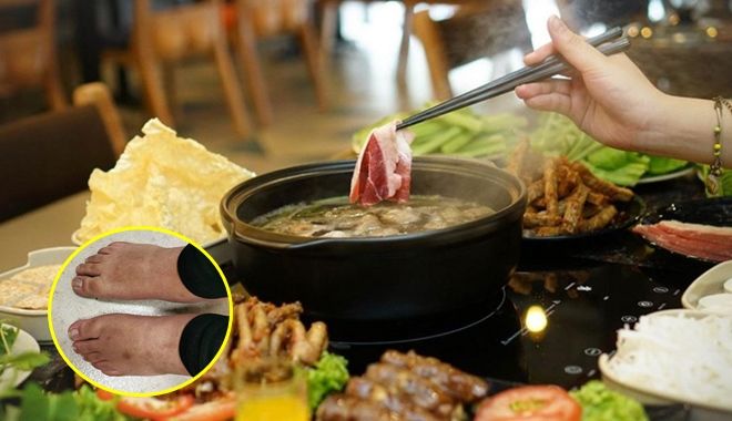 Cô gái 27 tuổi mắc bệnh gout vì ăn lẩu nhiều ngày liên tiếp