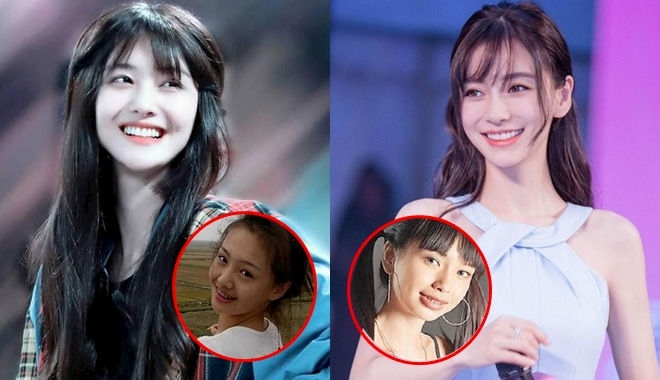 Trịnh Sảng, Angelababy và loạt sao Hoa ngữ đổi đời nhờ chỉnh răng