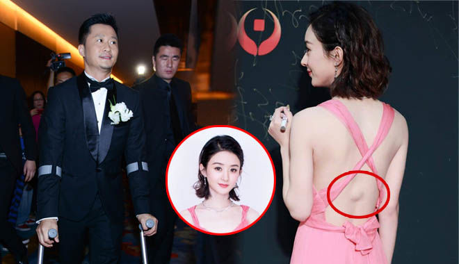 Tai nạn phim trường để lại di chứng: Triệu Lệ Dĩnh có cục u ở cột sống