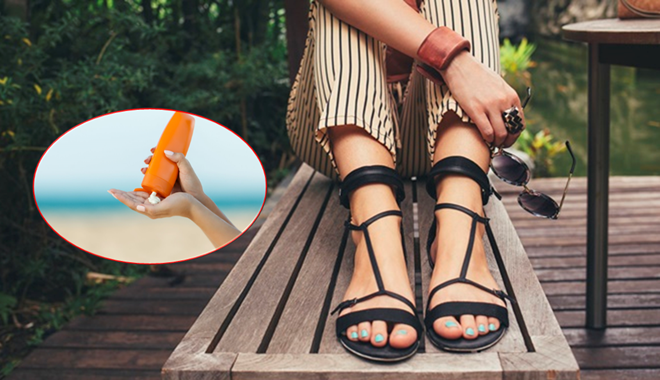 Đi sandal giữa ngày hè đổ lửa làm sao để da chân không loang lổ?