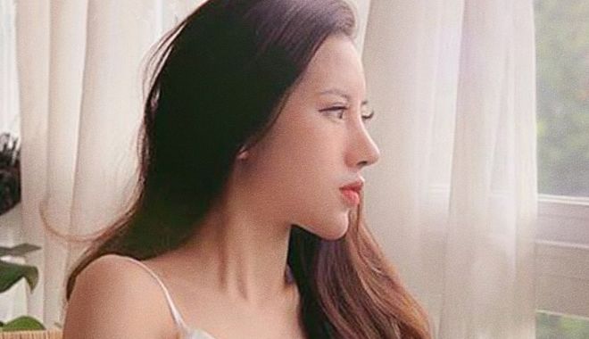 Giải mã cơn sốt nâng dáng mũi Queenform