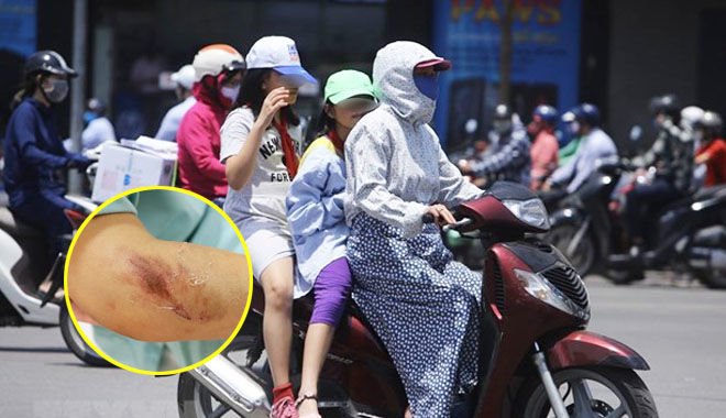 Khoác áo chống nắng của mẹ, bé gái 7 tuổi bị cuốn vào bánh xe máy