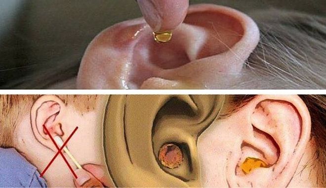 Cẩn thận: Viêm tai giữa khiến bé dễ tổn thương thính giác vĩnh viễn