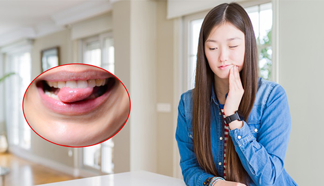 Những lần cắn nhầm lưỡi đau thấu trời xanh và nguyên nhân ít ai ngờ
