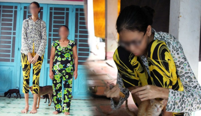 Cao 2m, cô gái Trà Vinh ước có đủ sức khỏe, không tạo gánh nặng cho mẹ