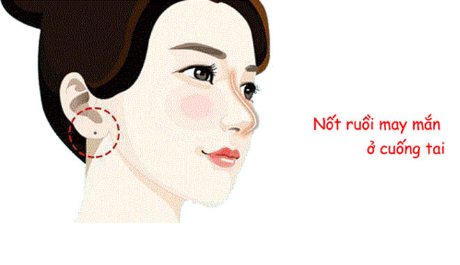 Nhân tướng học tiết lộ 5 vị trí nốt ruồi mang lại giàu sang, phú quý