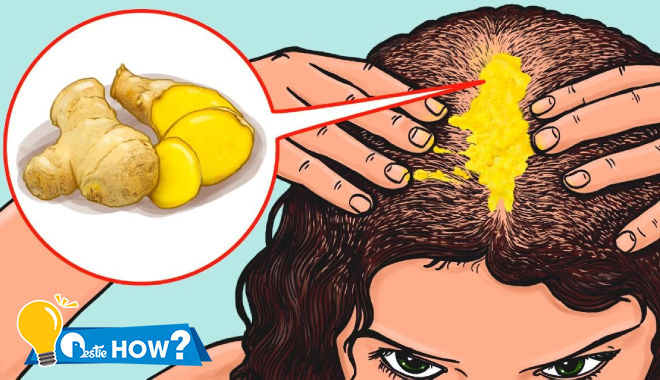 6 mẹo kích thích tóc mọc chỗ bị hói: Đắp tinh dầu gừng, tắm nắng