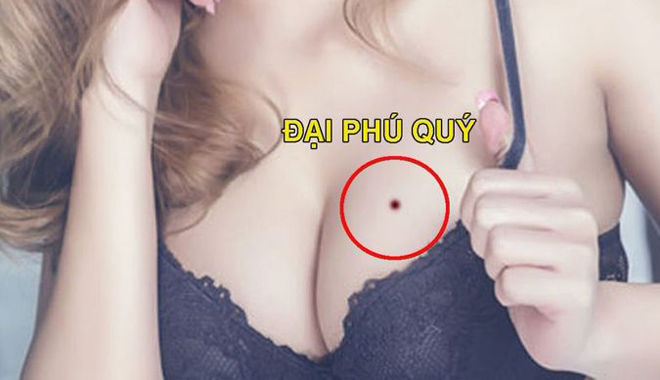 6 vị trí nốt ruồi cực may mắn, luôn được quý nhân dẫn lối khi khó khăn