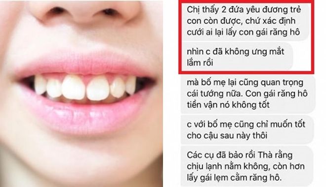 Lần đầu ra mắt nhà chồng tương lai, cô gái bị chê vì hàm răng hô