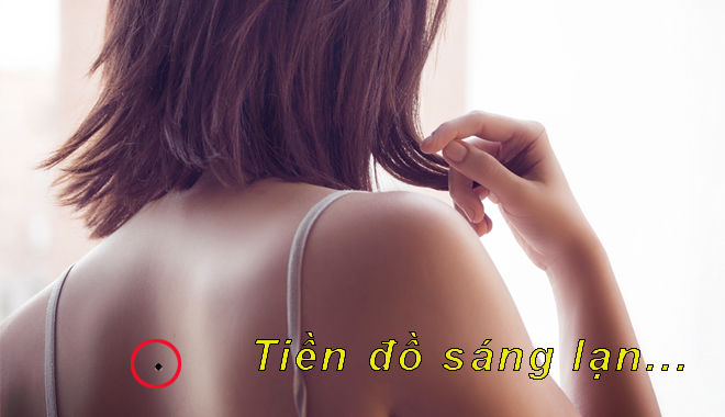 Giải mã 5 vị trí nốt ruồi trên lưng: ở giữa cột sống tiền đồ sáng lạn