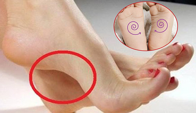 5 dấu hiệu ở bàn chân cho thấy bạn có số đại phú quý: Ngón cái tròn