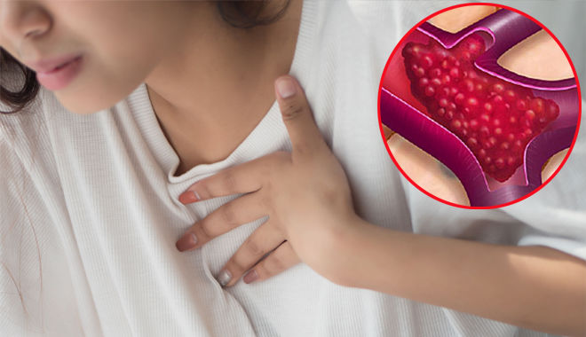 BS chỉ ra dấu hiệu cục máu đông từ "2 cơn đau, 2 vết đỏ và 2 nếp gấp"