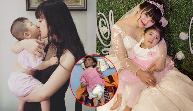 Hình ảnh em bé Lào Cai suy dinh dưỡng sau 5 năm được mẹ 9X nhận nuôi 
