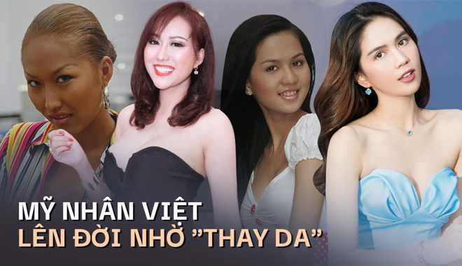 Mỹ nhân Việt lên đời nhờ "thay da": Phi Thanh Vân tốn 2 tỷ nhưng đáng