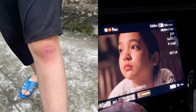Thương Ngày Nắng Về: Chu Diệp Anh te tua vì vai diễn vẫn rất bình tĩnh