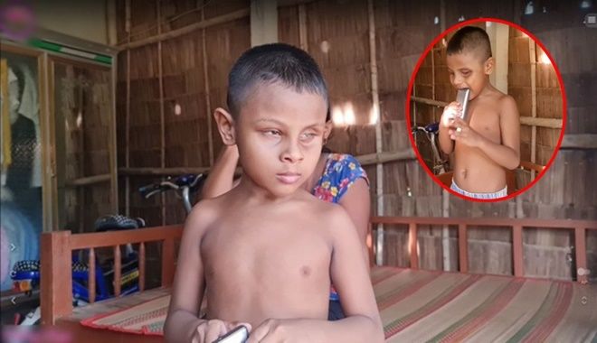 Chuyện lạ: Cậu bé mù Trà Vinh không ăn một hạt cơm chỉ gặm gỗ