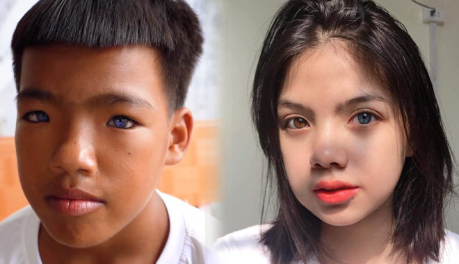 Kỳ lạ những trường hợp mắt 2 màu hiếm có tại Việt Nam 
