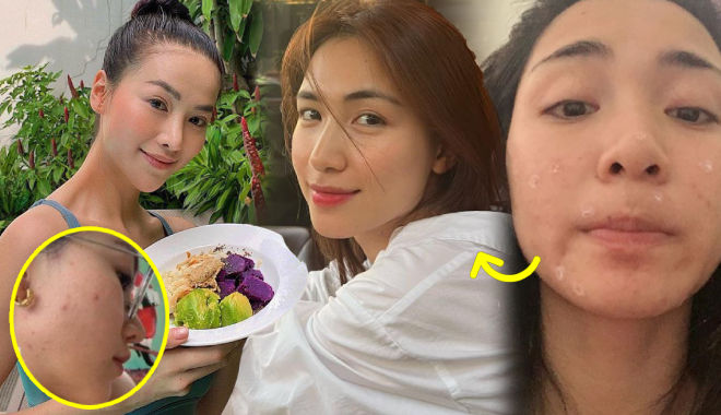 Mỹ nhân Việt trị mụn: Phương Khánh ăn sáng bằng đồ thuần chay